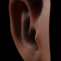 Otoplastia - Cirurgia das Orelhas Otoplastia - Cirurgia das Orelhas