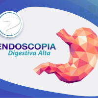 Endoscopia e Colonoscopia Endoscopia e Colonoscopia